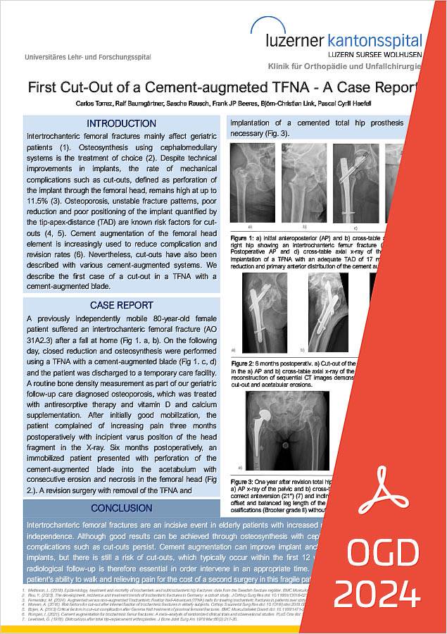 Poster OGD 2024 - First Cut-Out of a Cement-augmeted TFNA - A Case Report