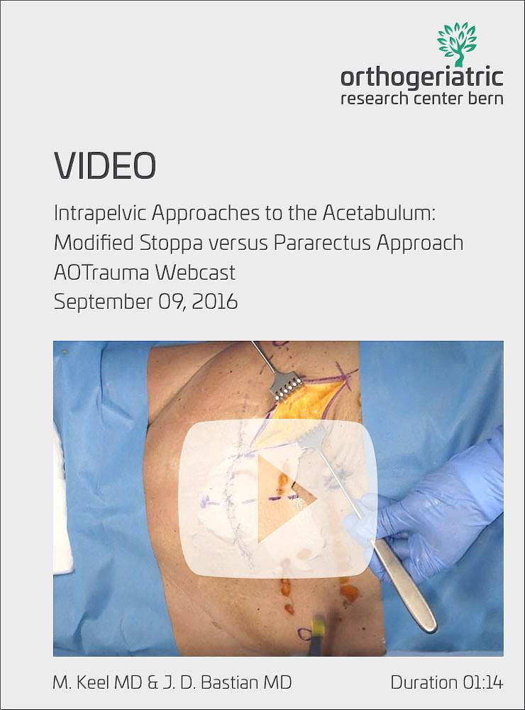 Intrapelvic Approaches to the Acetabulum